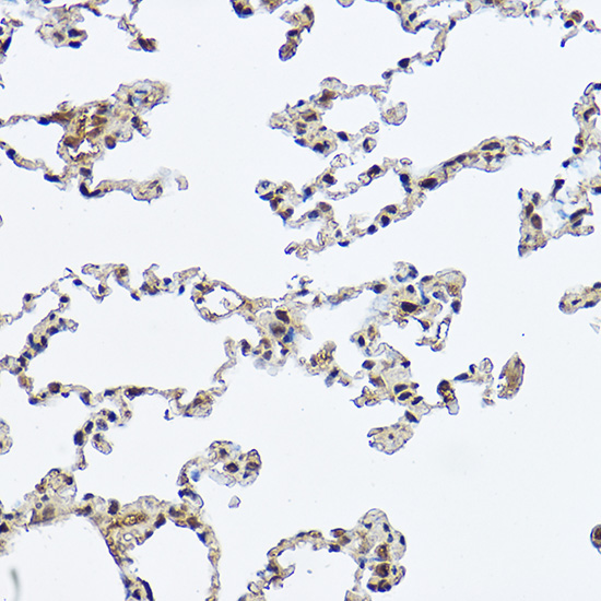 DDX3X Rabbit Polyclonal Antibody - Image 2