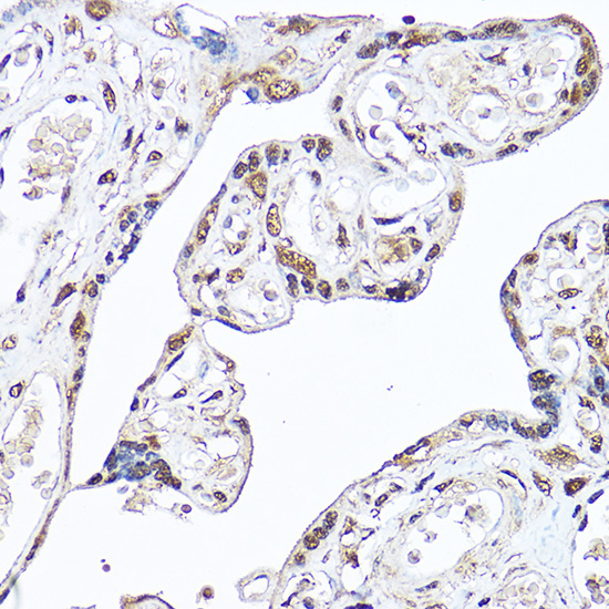 DDX3X Rabbit Polyclonal Antibody - Image 3