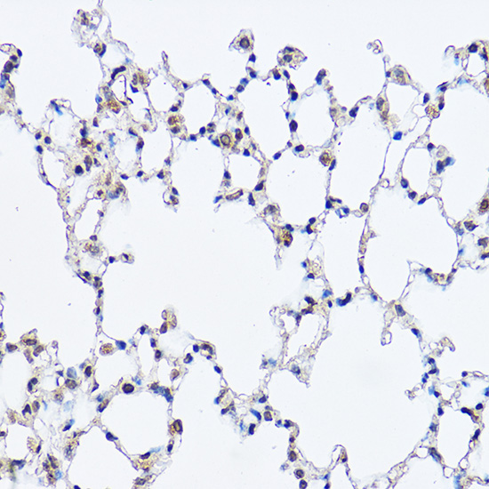 DDX3X Rabbit Polyclonal Antibody - Image 4
