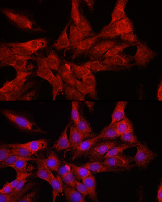 DDX3X Rabbit Polyclonal Antibody - Image 5