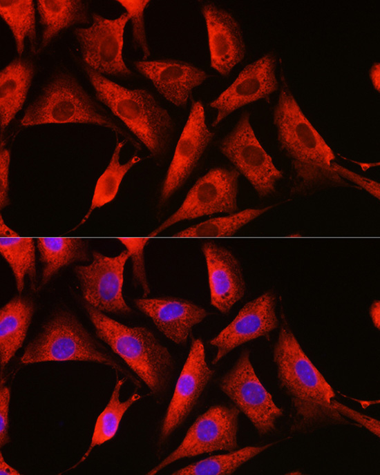 DDX3X Rabbit Polyclonal Antibody - Image 6