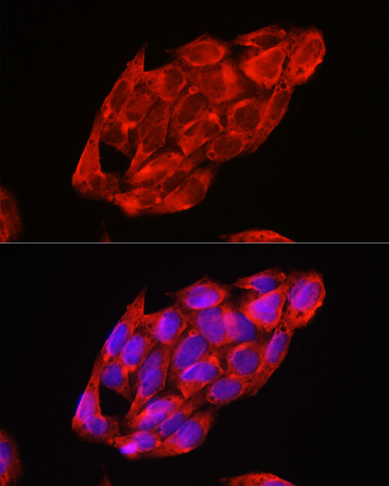 DDX3X Rabbit Polyclonal Antibody - Image 7
