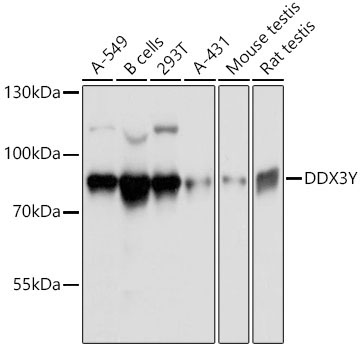 DDX3Y Rabbit Polyclonal Antibody