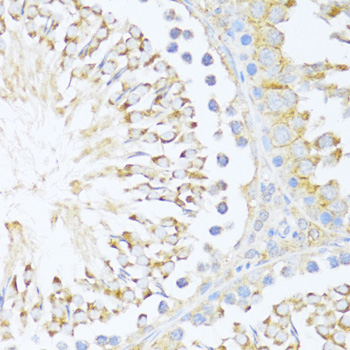 DDX3Y Rabbit Polyclonal Antibody - Image 2