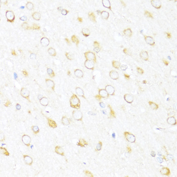 DDX3Y Rabbit Polyclonal Antibody - Image 3