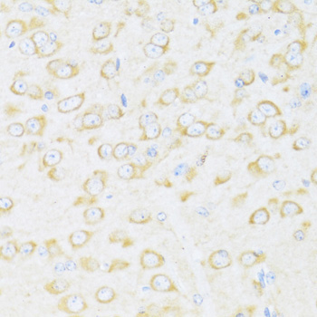 DDX3Y Rabbit Polyclonal Antibody - Image 4