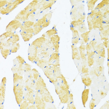 DDX3Y Rabbit Polyclonal Antibody - Image 5