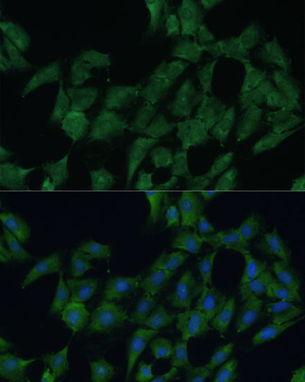DDX3Y Rabbit Polyclonal Antibody - Image 6