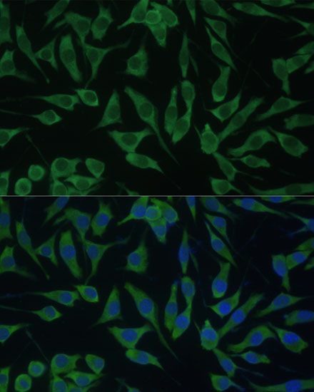 DDX3Y Rabbit Polyclonal Antibody - Image 7