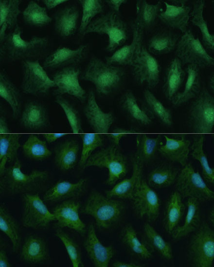 DDX3Y Rabbit Polyclonal Antibody - Image 8