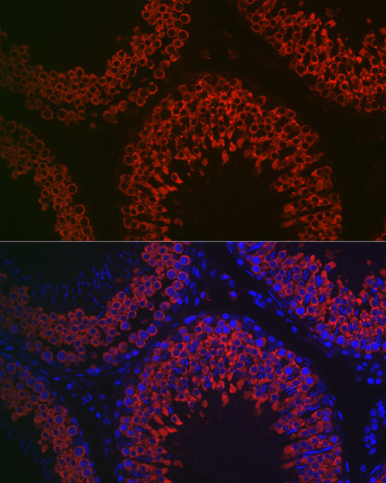 DDX4 Rabbit Polyclonal Antibody - Image 3
