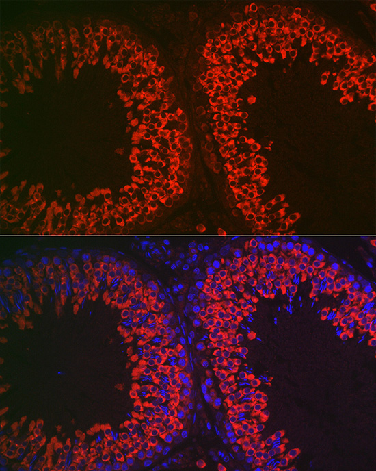 DDX4 Rabbit Polyclonal Antibody - Image 5
