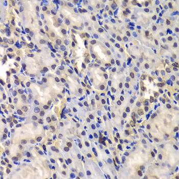 DDX41 Rabbit Polyclonal Antibody - Image 2