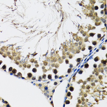 DDX41 Rabbit Polyclonal Antibody - Image 3