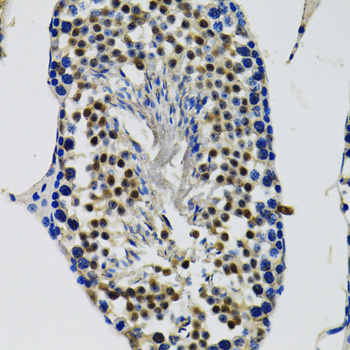 DDX41 Rabbit Polyclonal Antibody - Image 4