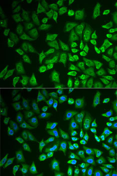 DDX41 Rabbit Polyclonal Antibody - Image 5