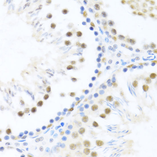 DDX46 Rabbit Polyclonal Antibody - Image 2