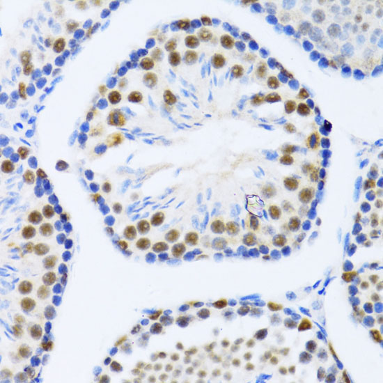 DDX46 Rabbit Polyclonal Antibody - Image 3