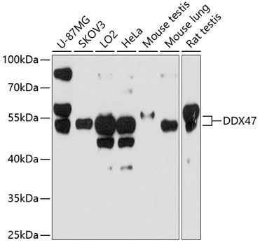 DDX47 Rabbit Polyclonal Antibody