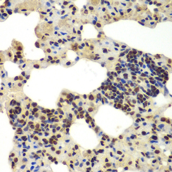 DDX5 Rabbit Polyclonal Antibody - Image 2