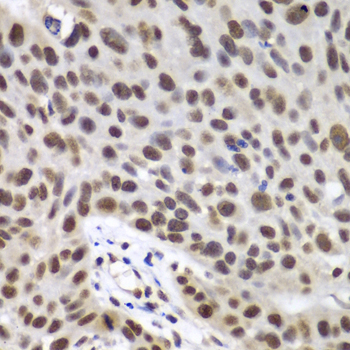 DDX5 Rabbit Polyclonal Antibody - Image 3