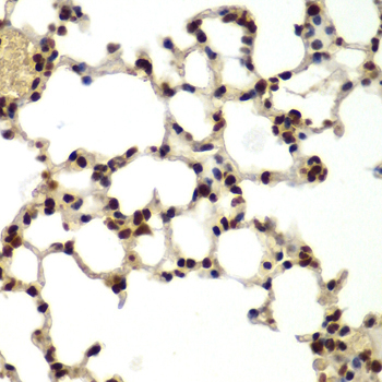 DDX5 Rabbit Polyclonal Antibody - Image 4