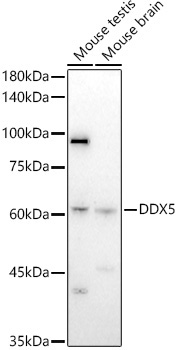 DDX5 Rabbit Polyclonal Antibody - Image 2