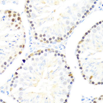DDX50 Rabbit Polyclonal Antibody - Image 2