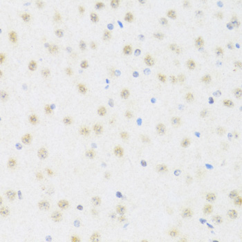 DDX50 Rabbit Polyclonal Antibody - Image 3
