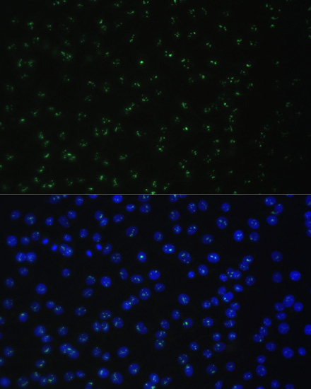 DDX50 Rabbit Polyclonal Antibody - Image 4
