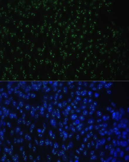 DDX50 Rabbit Polyclonal Antibody - Image 5