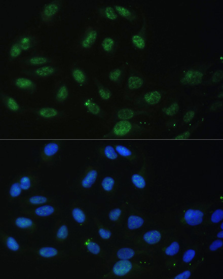 DDX50 Rabbit Polyclonal Antibody - Image 6