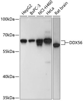 DDX56 Rabbit Polyclonal Antibody