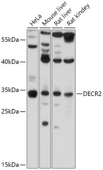 DECR2 Rabbit Polyclonal Antibody