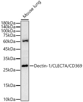 Dectin-1/CLEC7A/CD369 Rabbit Polyclonal Antibody
