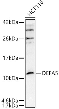 DEFA5 Rabbit Polyclonal Antibody