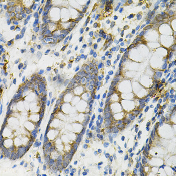 DEFB132 Rabbit Polyclonal Antibody