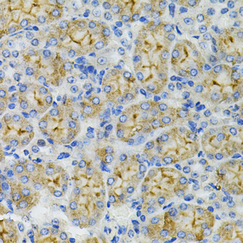 DEFB132 Rabbit Polyclonal Antibody - Image 3
