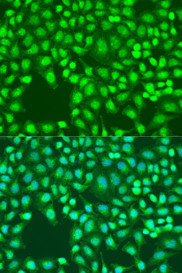 Defb26 Rabbit Polyclonal Antibody