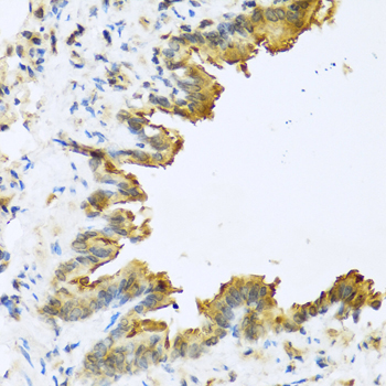 DEFB4A Rabbit Polyclonal Antibody - Image 2
