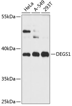 DEGS1 Rabbit Polyclonal Antibody