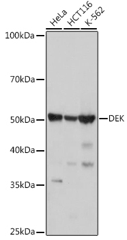 DEK Rabbit Monoclonal Antibody