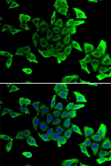 Delta-sarcoglycan (SGCD) Rabbit Polyclonal Antibody - Image 2