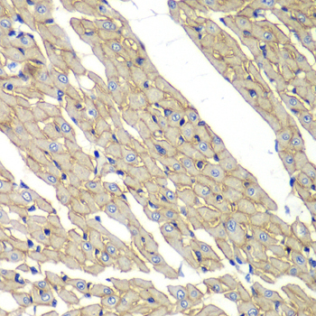 Delta-sarcoglycan (SGCD) Rabbit Polyclonal Antibody - Image 2