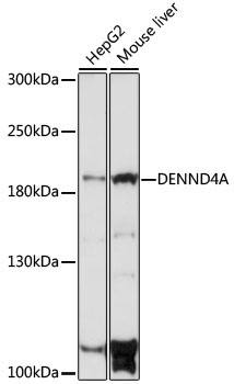 DENND4A Rabbit Polyclonal Antibody