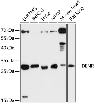 DENR Rabbit Polyclonal Antibody