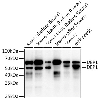 DEP1 Rabbit Polyclonal Antibody