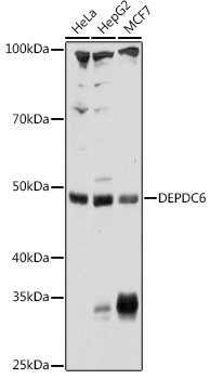 DEPDC6 Rabbit Polyclonal Antibody