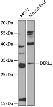 DERL1 Rabbit Polyclonal Antibody