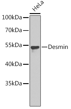 Desmin Rabbit Polyclonal Antibody